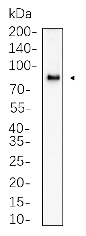 CPT1A Rabbit Monoclonal antibody | 兔单抗 | EnkiLife恩玑生命