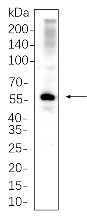 PAX-8 Rabbit Monoclonal antibody | 兔单抗 | EnkiLife恩玑生命