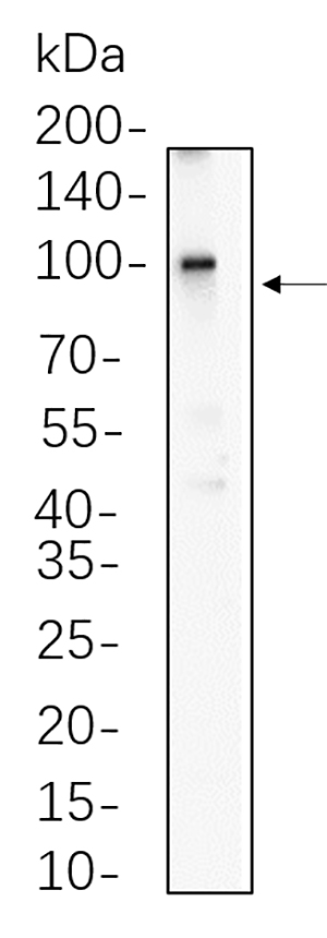 β Catenin (Phospho Thr41/Ser45) Rabbit Monoclonal antibody | 兔单抗 | EnkiLife恩玑生命