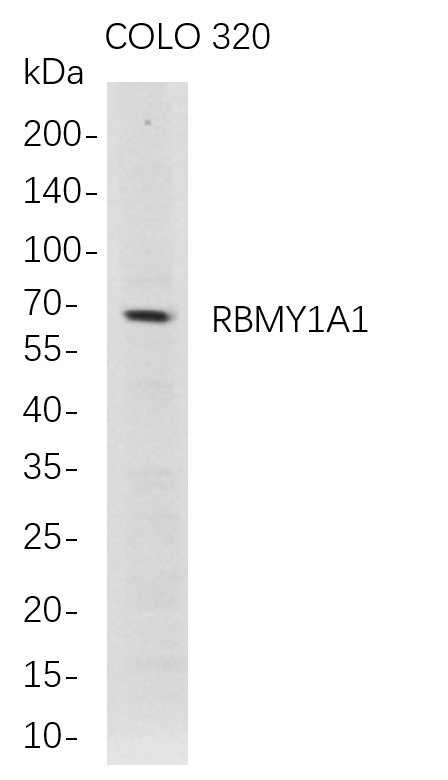 RBMY1A1 Rabbit Monoclonal antibody | 兔单抗 | EnkiLife恩玑生命