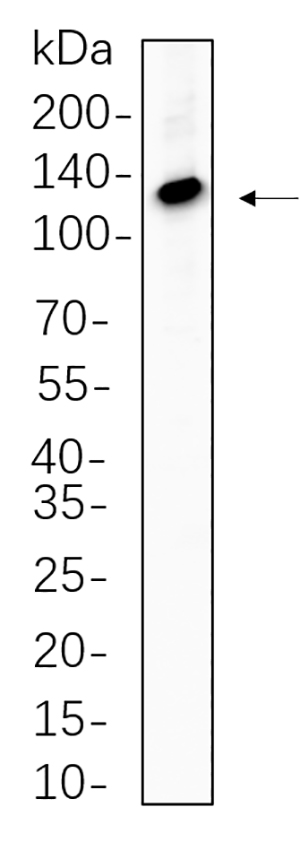 ATP-Citrate Lyase Rabbit Monoclonal antibody | 兔单抗 | EnkiLife恩玑生命