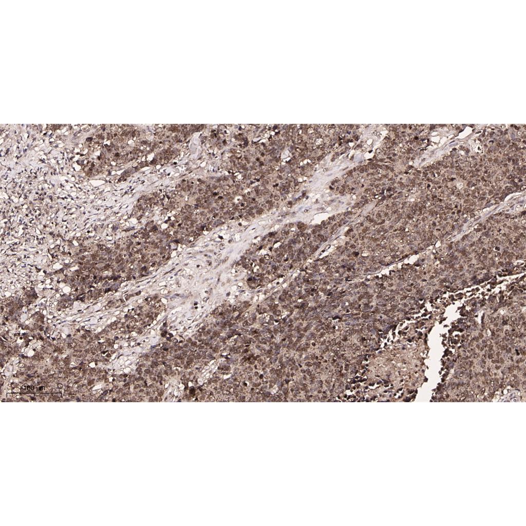 Sumo 1 Rabbit Monoclonal antibody | 兔单抗 | EnkiLife恩玑生命
