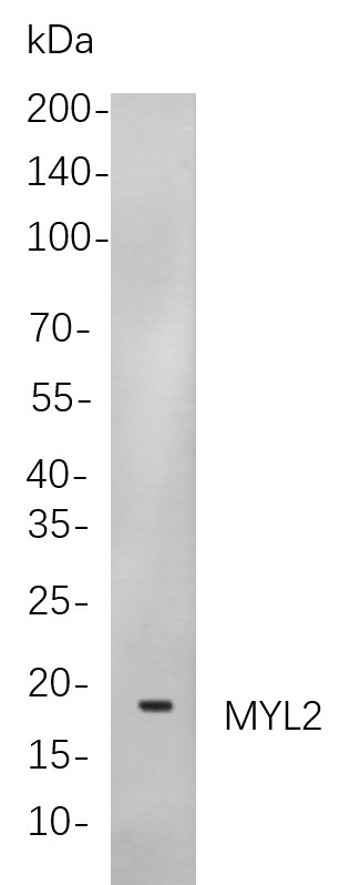 Myosin Light Chain 2 Rabbit Monoclonal antibody | 兔单抗 | EnkiLife恩玑生命