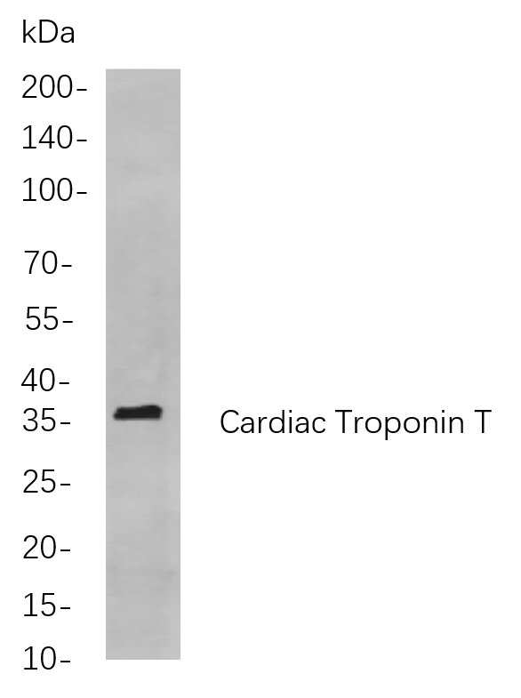 Cardiac Troponin T Rabbit Monoclonal antibody | 兔单抗 | EnkiLife恩玑生命