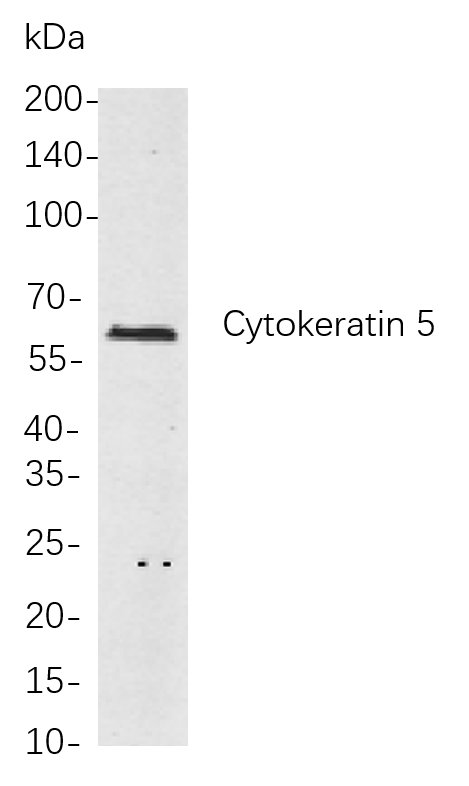 Cytokeratin 5 Rabbit Monoclonal antibody | 兔单抗 | EnkiLife恩玑生命