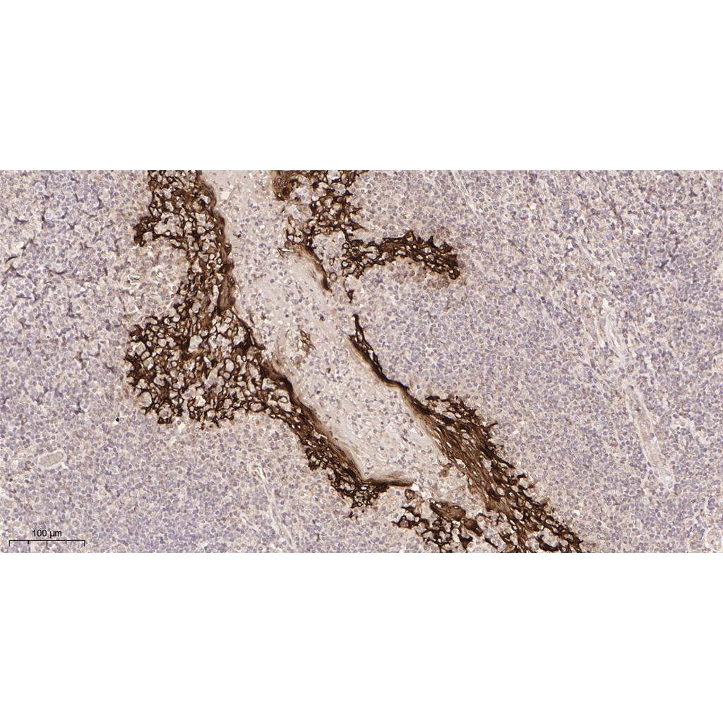 Cytokeratin 5 Rabbit Monoclonal antibody | 兔单抗 | EnkiLife恩玑生命