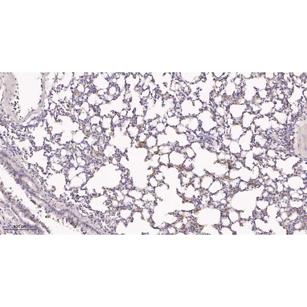 Cytokeratin 5 Rabbit Monoclonal antibody | 兔单抗 | EnkiLife恩玑生命