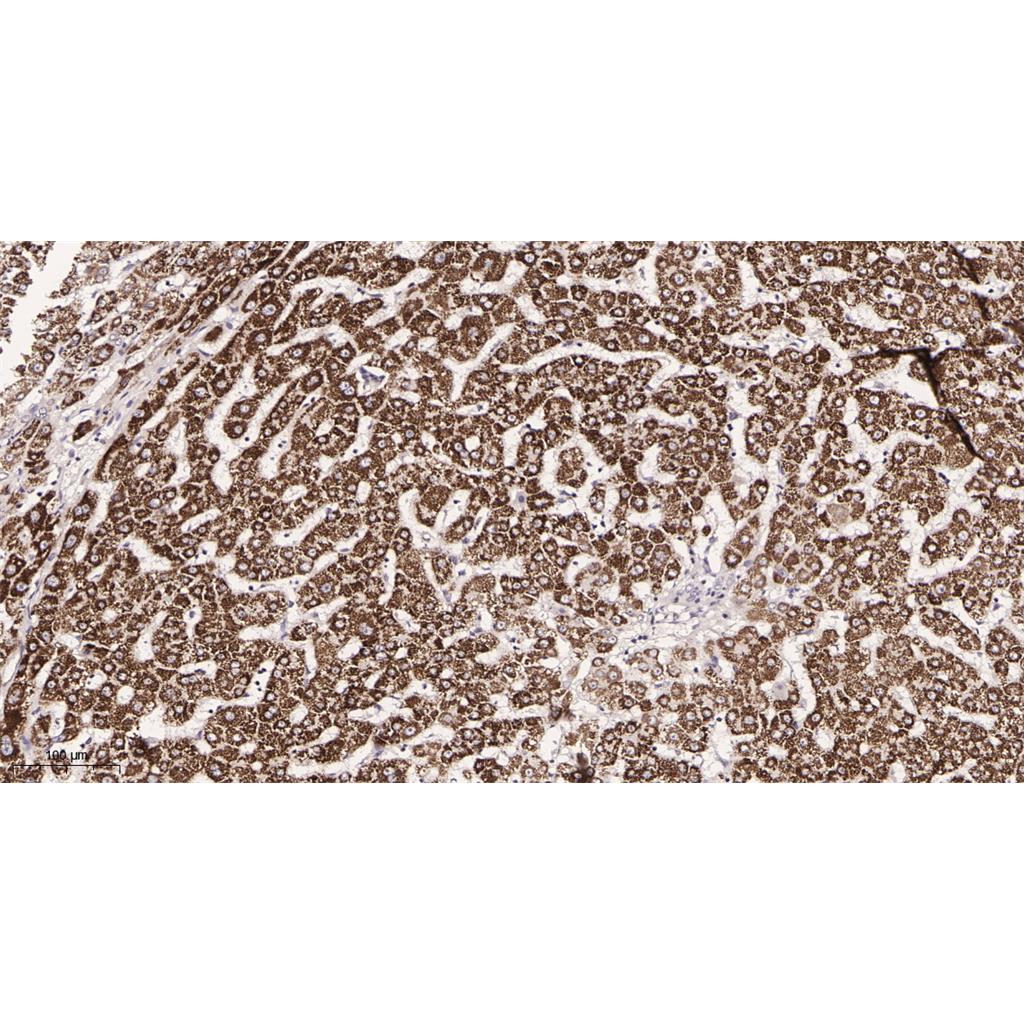 Cathepsin D Rabbit Monoclonal antibody | 兔单抗 | EnkiLife恩玑生命