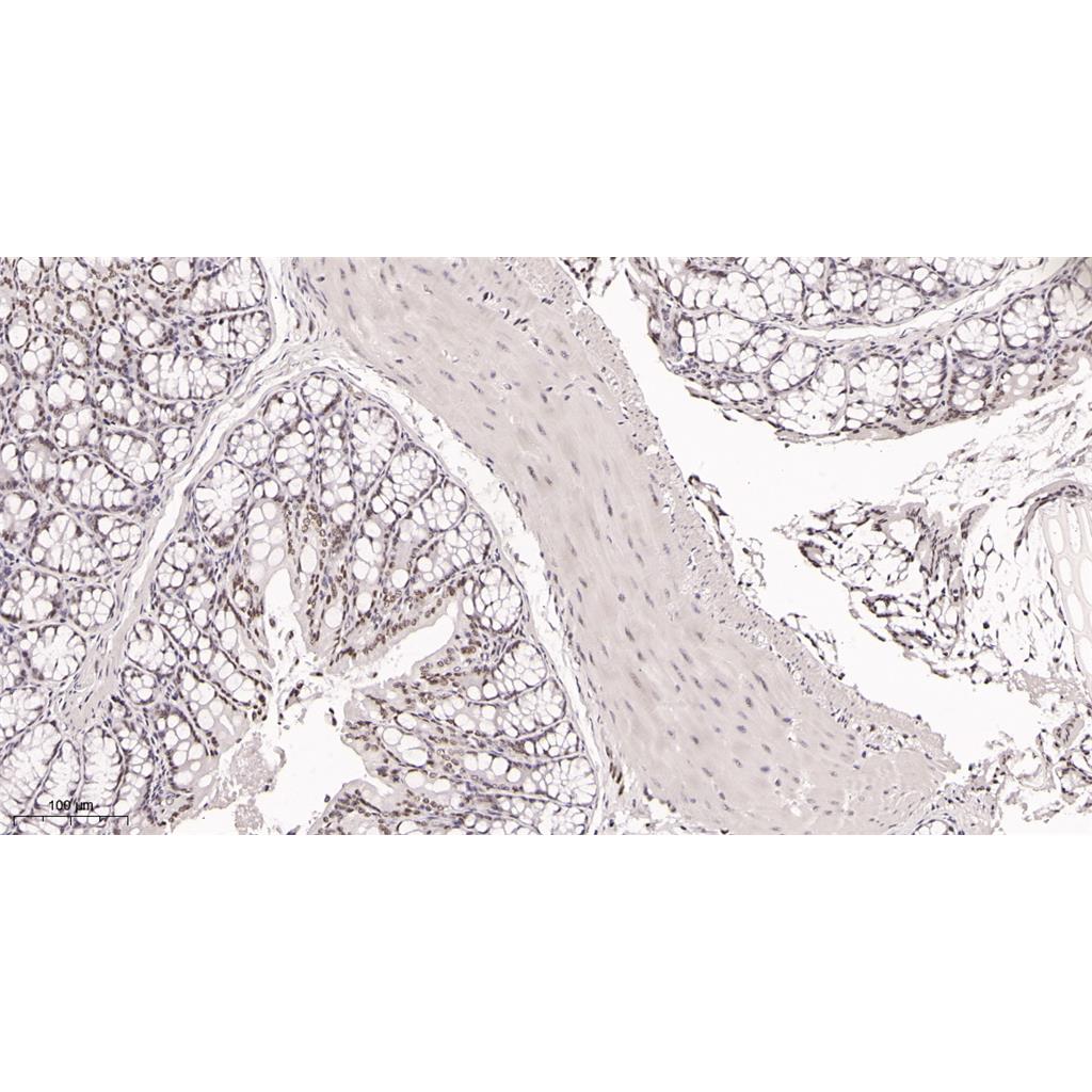 KDM1A Rabbit Monoclonal antibody | 兔单抗 | EnkiLife恩玑生命