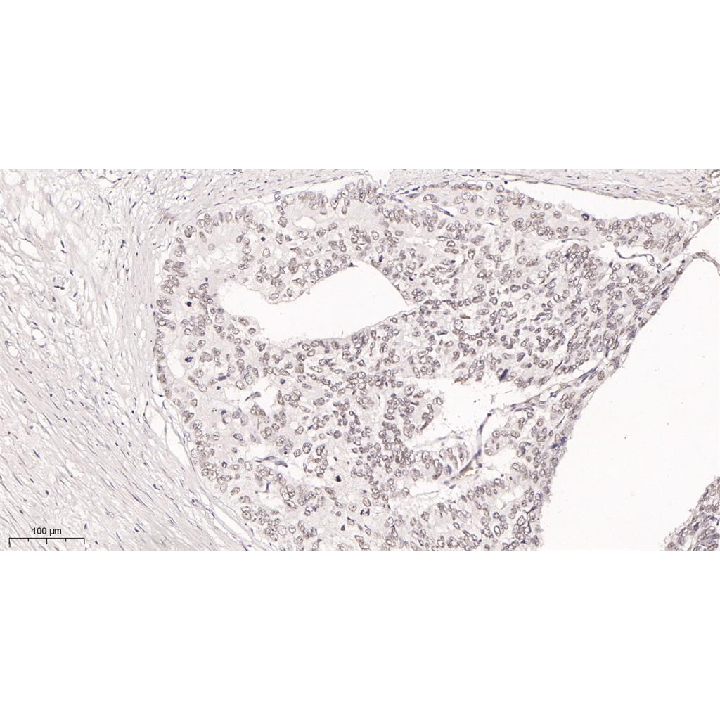 KDM1A Rabbit Monoclonal antibody | 兔单抗 | EnkiLife恩玑生命
