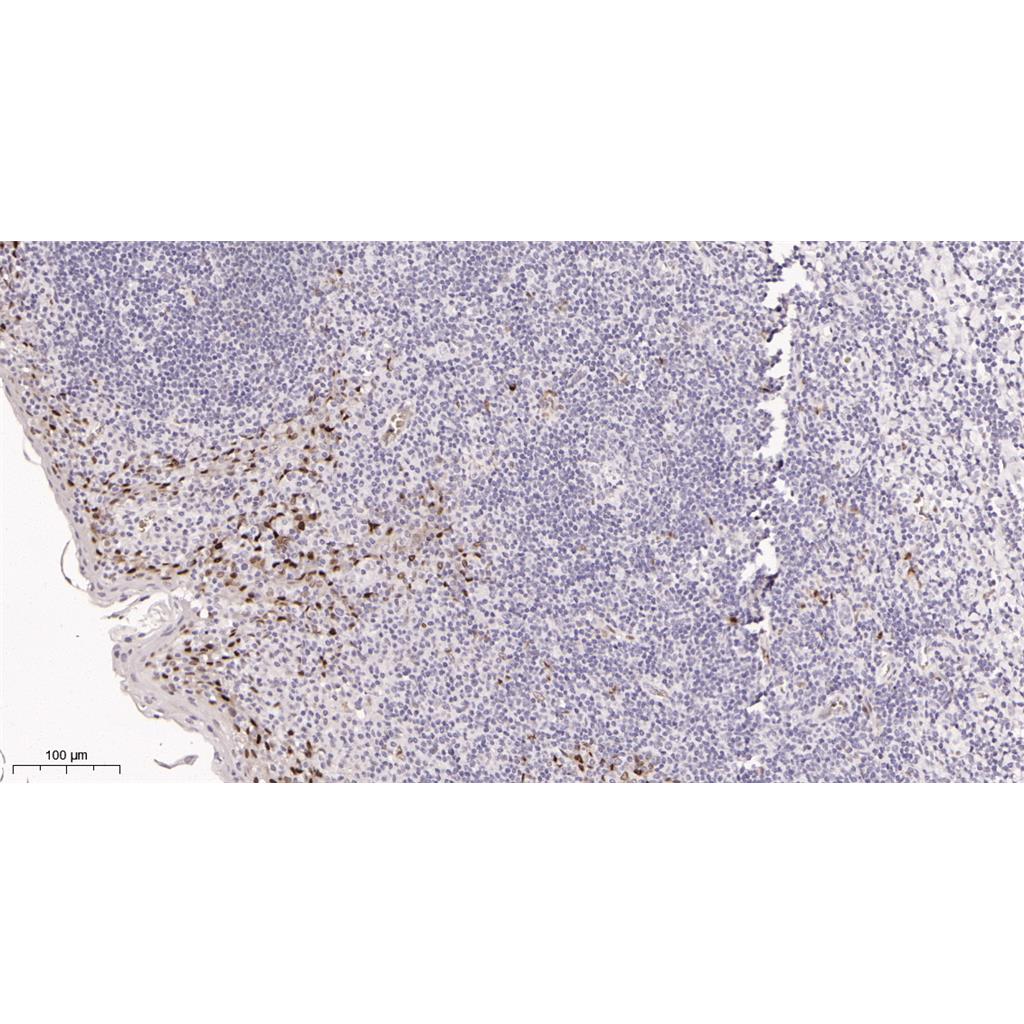 Cyclin D1 Rabbit Monoclonal antibody | 兔单抗 | EnkiLife恩玑生命