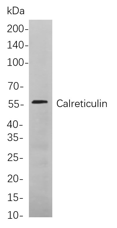 Calreticulin Rabbit Monoclonal antibody | 兔单抗 | EnkiLife恩玑生命