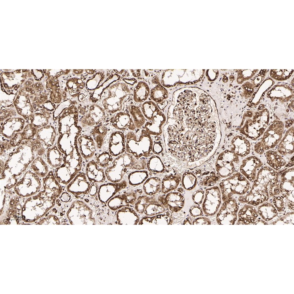 Calreticulin Rabbit Monoclonal antibody | 兔单抗 | EnkiLife恩玑生命