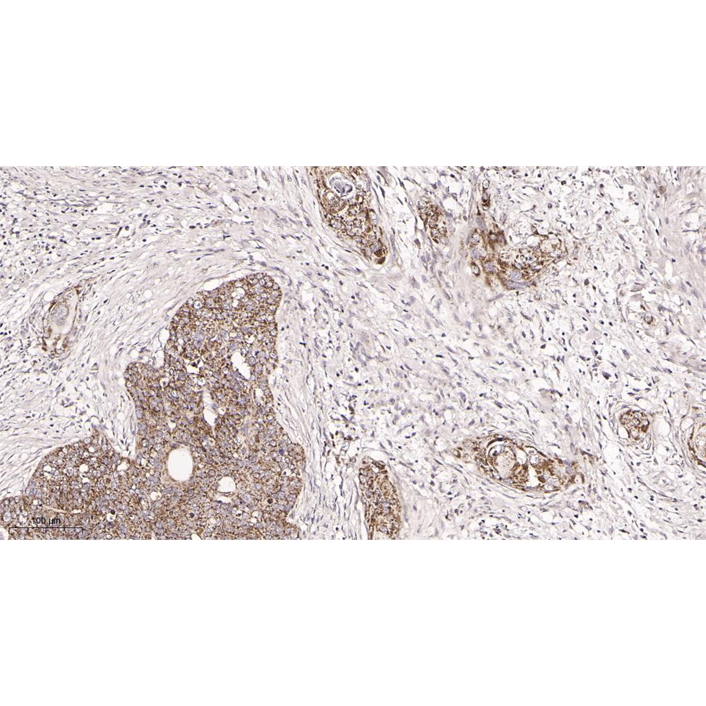 TOMM20 Rabbit Monoclonal antibody | 兔单抗 | EnkiLife恩玑生命