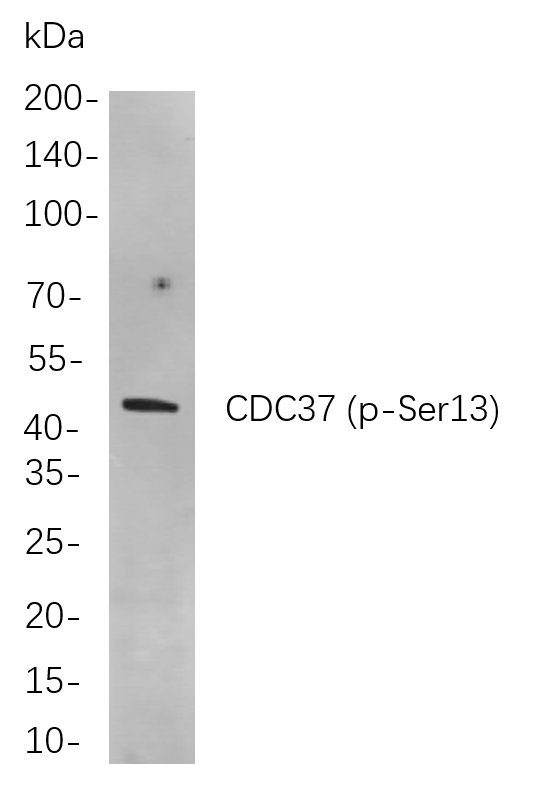 CDC37 (Phospho Ser13) Rabbit Monoclonal antibody | 兔单抗 | EnkiLife恩玑生命