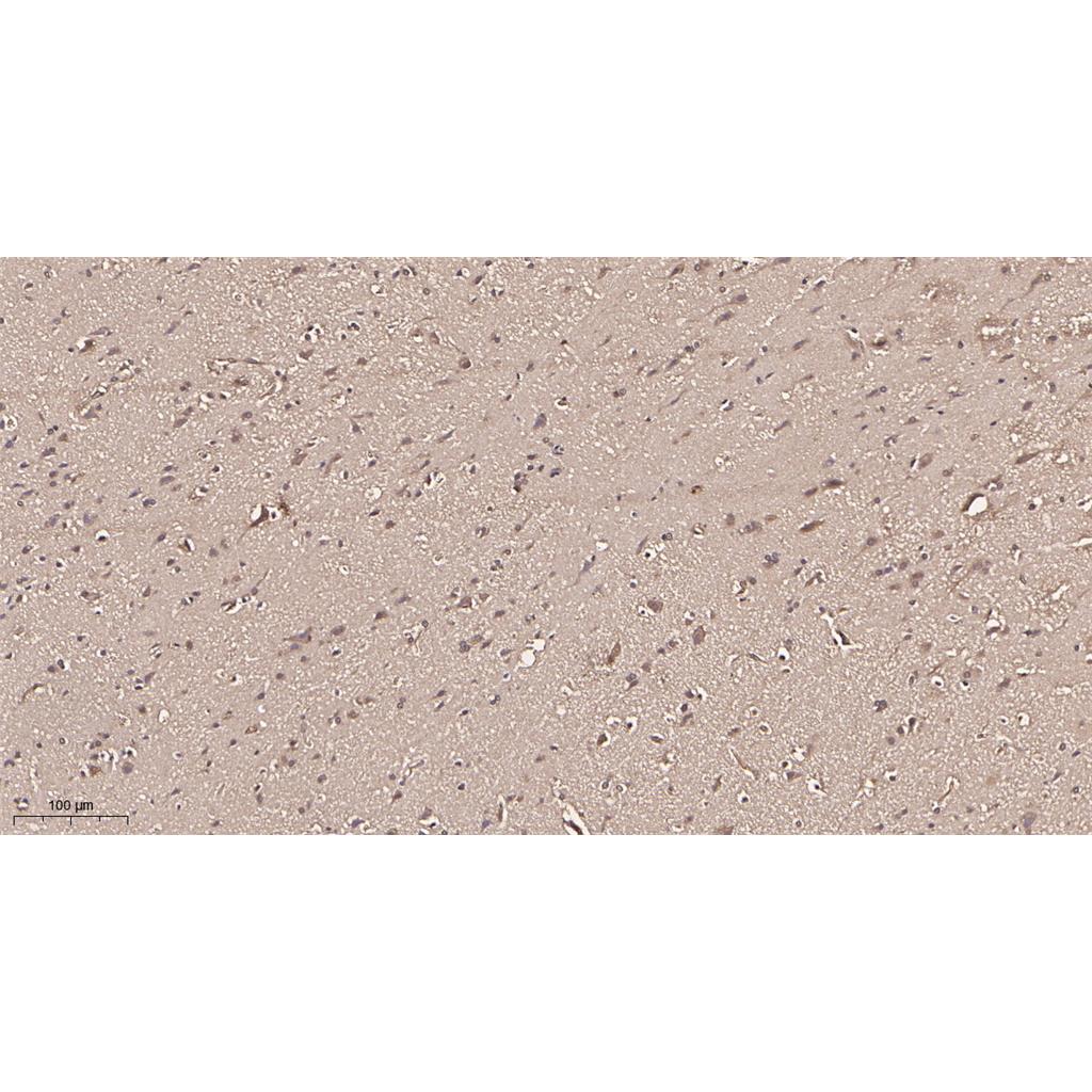 CDC37 (Phospho Ser13) Rabbit Monoclonal antibody | 兔单抗 | EnkiLife恩玑生命