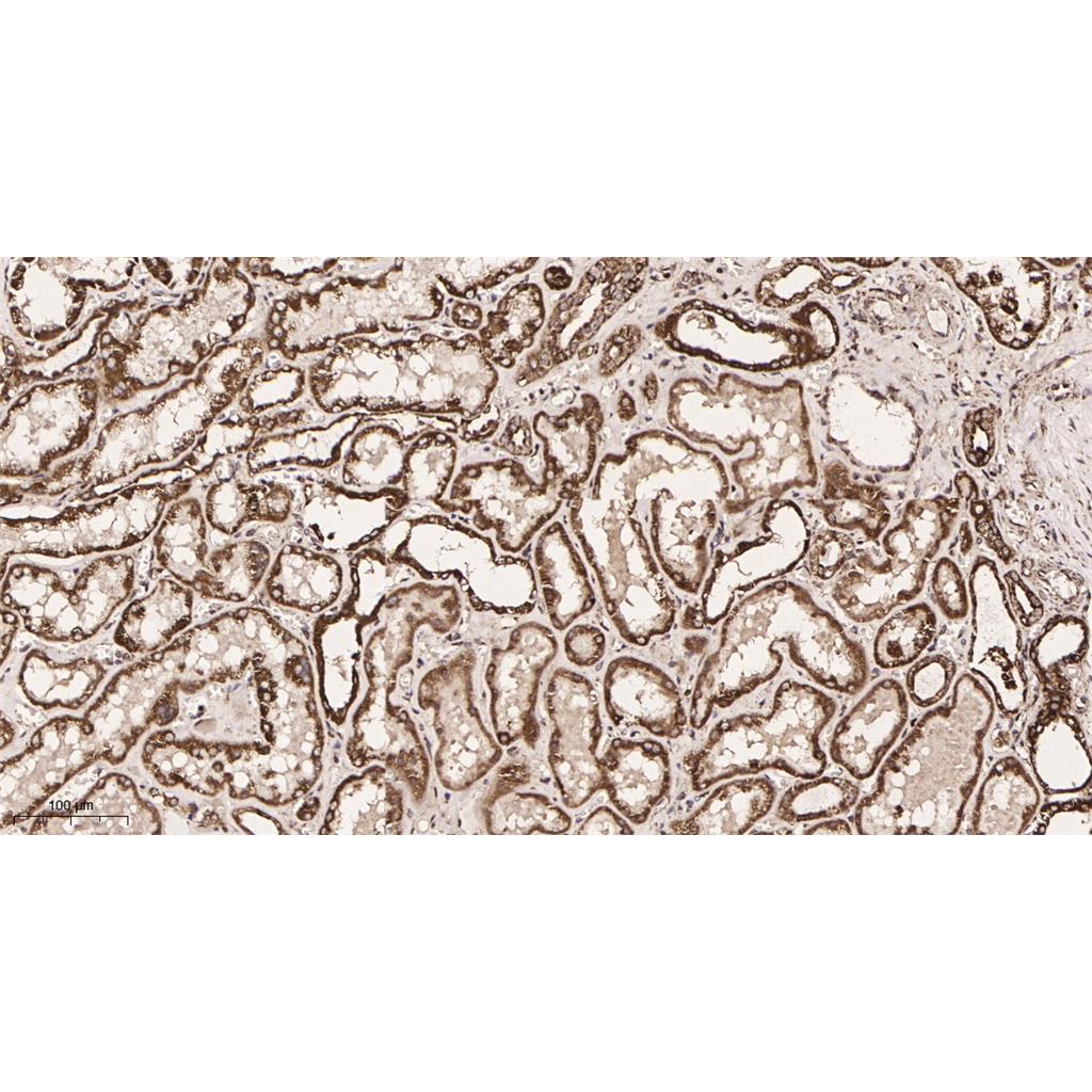 Prohibitin Rabbit Monoclonal antibody | 兔单抗 | EnkiLife恩玑生命