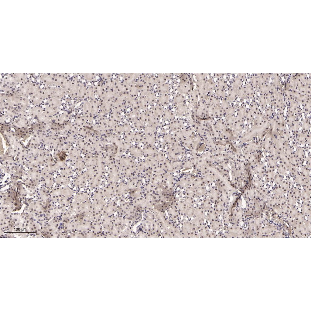 Prohibitin Rabbit Monoclonal antibody | 兔单抗 | EnkiLife恩玑生命
