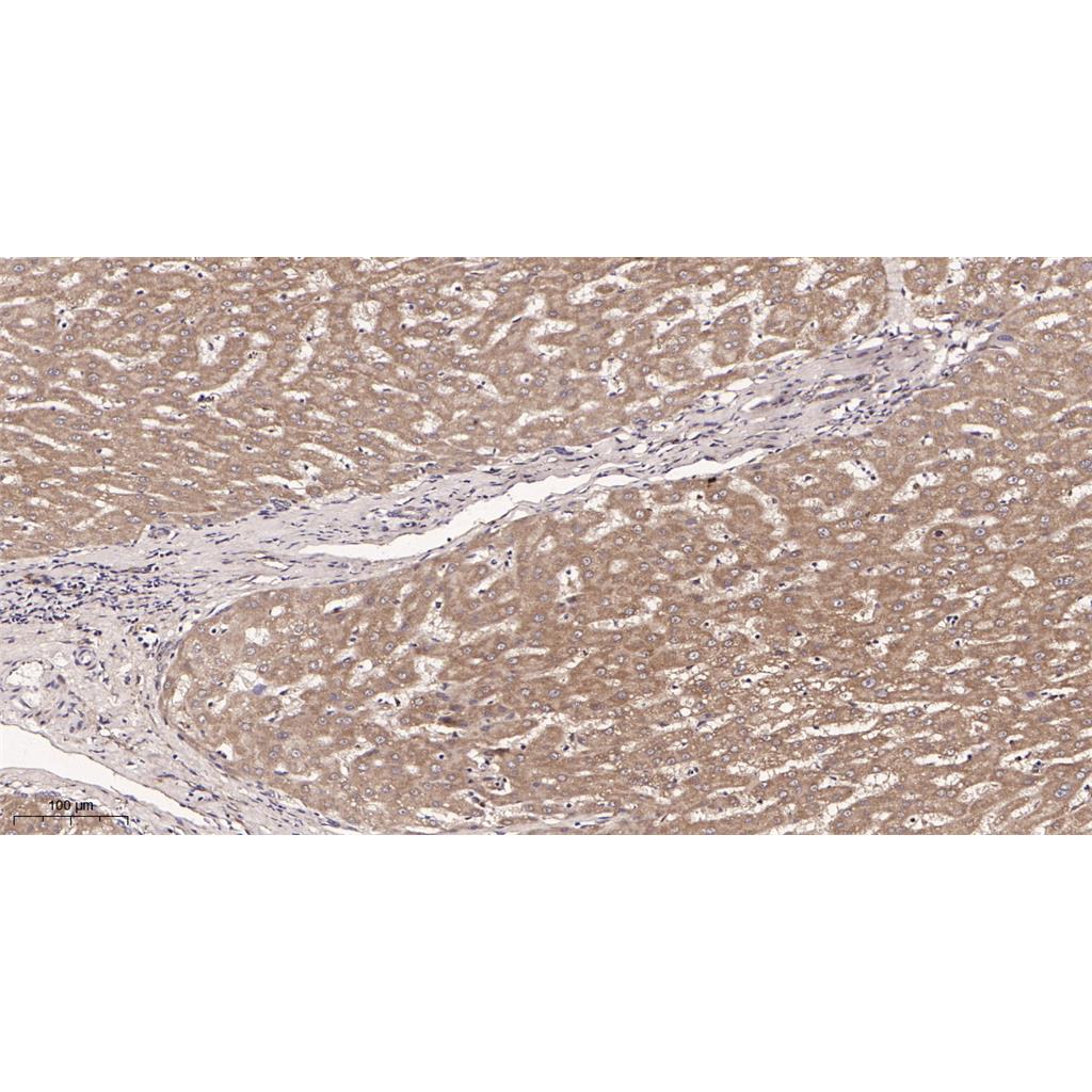 Neuropilin 1 Rabbit Monoclonal antibody | 兔单抗 | EnkiLife恩玑生命