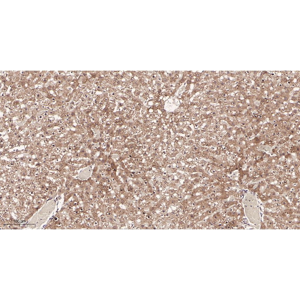Neuropilin 1 Rabbit Monoclonal antibody | 兔单抗 | EnkiLife恩玑生命