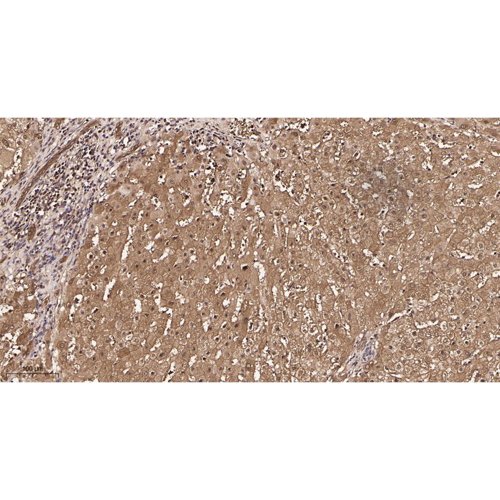 Lactate Dehydrogenase Rabbit Monoclonal antibody | 兔单抗 | EnkiLife恩玑生命