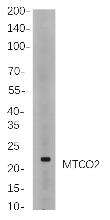 MTCO2 rabbit Rabbit Monoclonal antibody | 兔单抗 | EnkiLife恩玑生命