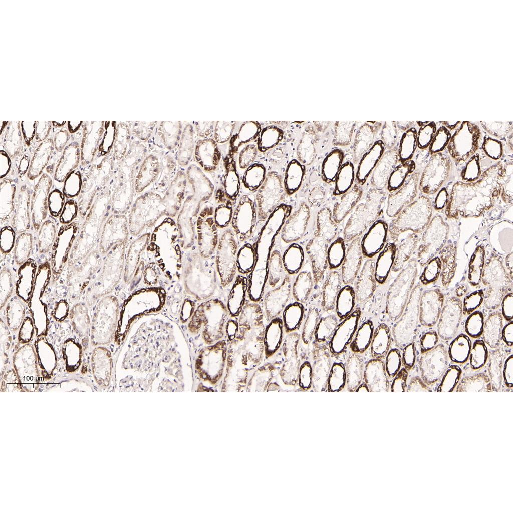 MTCO2 rabbit Rabbit Monoclonal antibody | 兔单抗 | EnkiLife恩玑生命