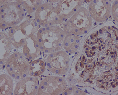ROCK1 Rabbit Polyclonal Antibody | 兔多抗 | EnkiLife恩玑生命