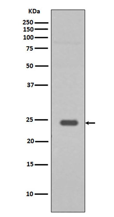 Rab9 Rabbit Polyclonal Antibody | 兔多抗 | EnkiLife恩玑生命