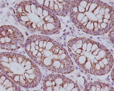 TOMM20 Rabbit Polyclonal Antibody | 兔多抗 | EnkiLife恩玑生命