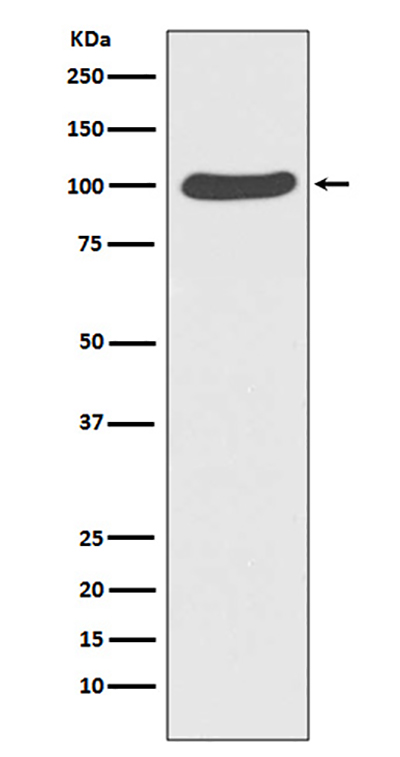CTNNA1 Rabbit Polyclonal Antibody | 兔多抗 | EnkiLife恩玑生命