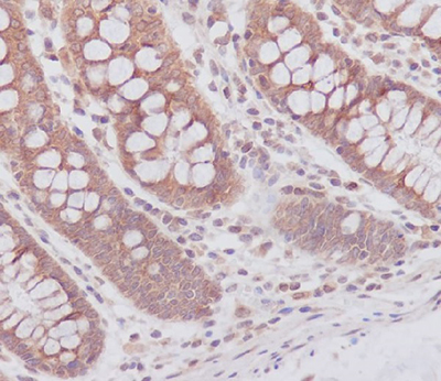 ATG7 Rabbit Polyclonal Antibody | 兔多抗 | EnkiLife恩玑生命