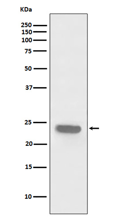 PARK7/DJ1 Rabbit Polyclonal Antibody | 兔多抗 | EnkiLife恩玑生命