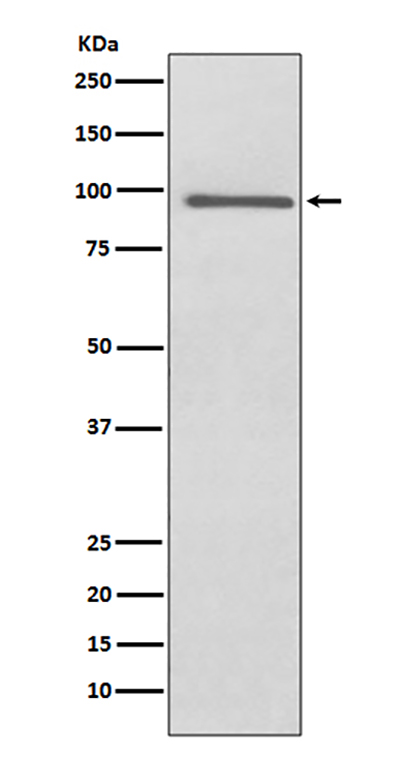 PROX1 Rabbit Polyclonal Antibody | 兔多抗 | EnkiLife恩玑生命
