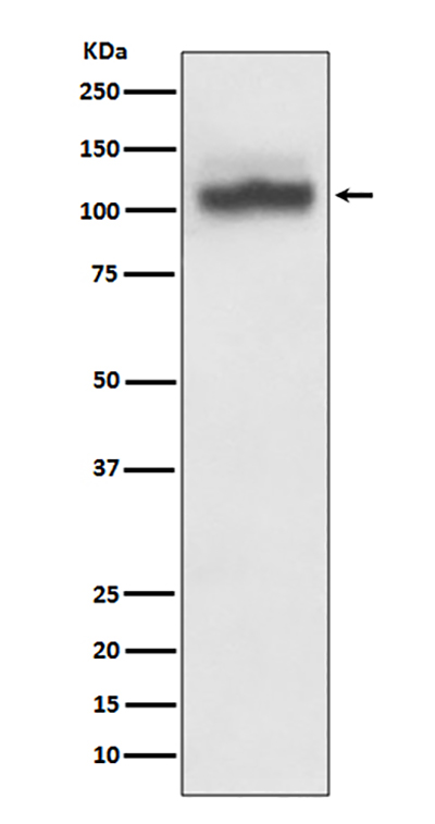 SERCA2 ATPase Rabbit Polyclonal Antibody | 兔多抗 | EnkiLife恩玑生命