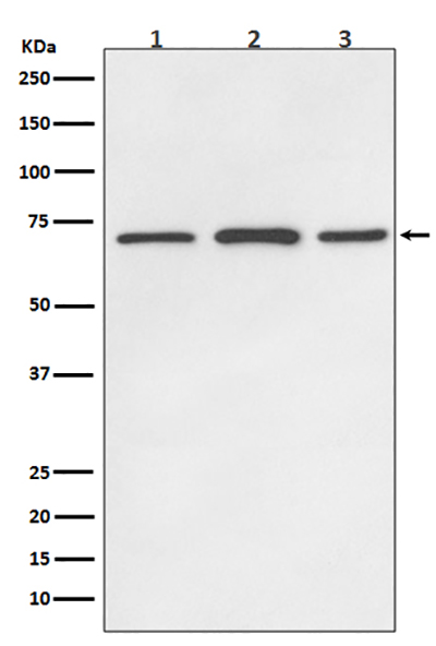 SDHA Rabbit Polyclonal Antibody | 兔多抗 | EnkiLife恩玑生命
