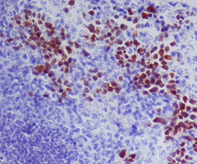 GATA1 Rabbit Polyclonal Antibody | 兔多抗 | EnkiLife恩玑生命