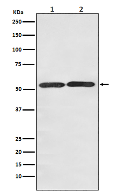 Glucose Transporter GLUT3 Rabbit Polyclonal Antibody | 兔多抗 | EnkiLife恩玑生命