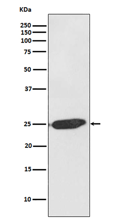 SNAP25 Rabbit Polyclonal Antibody | 兔多抗 | EnkiLife恩玑生命
