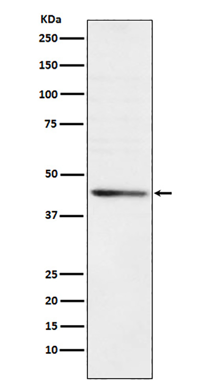RRM2 Rabbit Polyclonal Antibody | 兔多抗 | EnkiLife恩玑生命