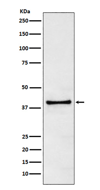 TRIB3 Rabbit Polyclonal Antibody | 兔多抗 | EnkiLife恩玑生命