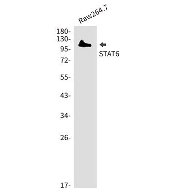 STAT6 Rabbit Polyclonal Antibody | 兔多抗 | EnkiLife恩玑生命