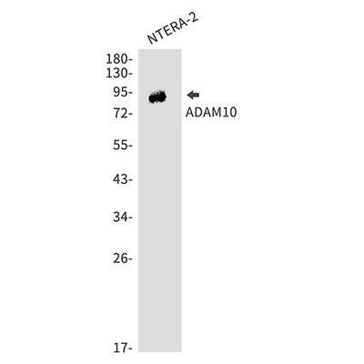ADAM10 Rabbit Polyclonal Antibody | 兔多抗 | EnkiLife恩玑生命