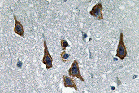 ABCG2 Rabbit Polyclonal Antibody | 兔多抗 | EnkiLife恩玑生命