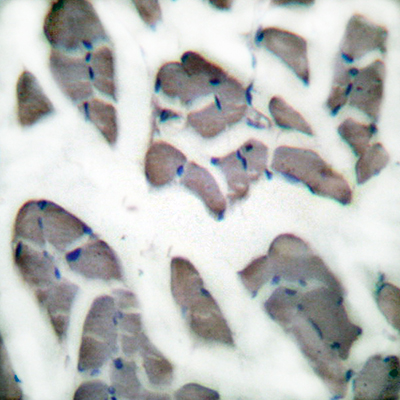 Desmin Rabbit Polyclonal Antibody | 兔多抗 | EnkiLife恩玑生命