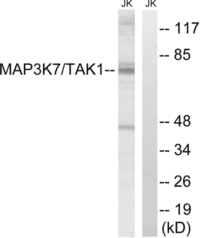 TAK1 Rabbit Polyclonal Antibody | 兔多抗 | EnkiLife恩玑生命