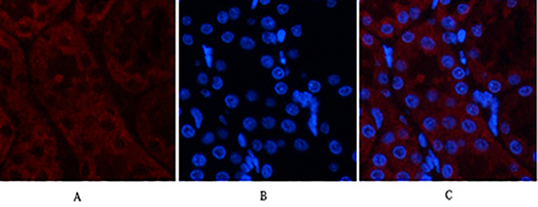 TAK1 Rabbit Polyclonal Antibody | 兔多抗 | EnkiLife恩玑生命