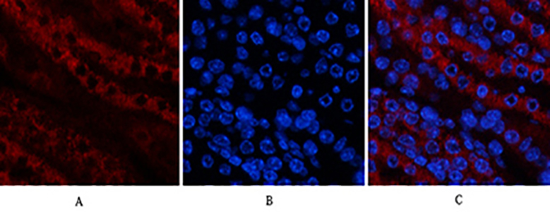 TAK1 Rabbit Polyclonal Antibody | 兔多抗 | EnkiLife恩玑生命