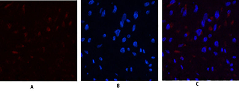 JAK3 Rabbit Polyclonal Antibody | 兔多抗 | EnkiLife恩玑生命