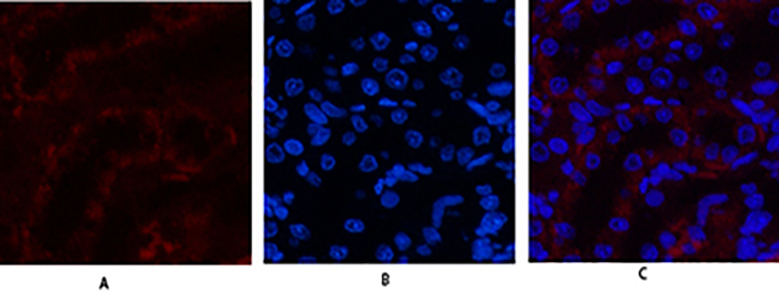 JAK3 Rabbit Polyclonal Antibody | 兔多抗 | EnkiLife恩玑生命